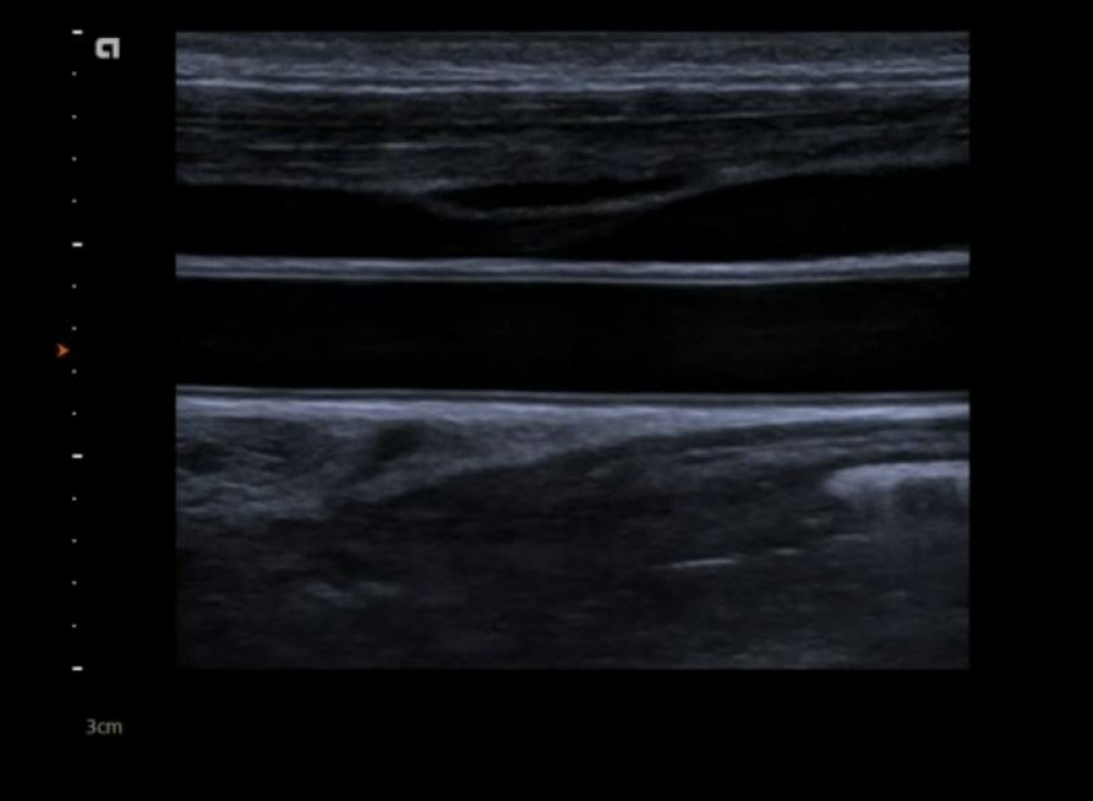 1-introduction-to-carotid-ultrasound-123sonography